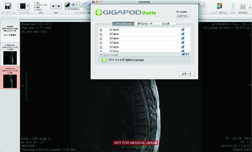 gigapod 4 osirix
